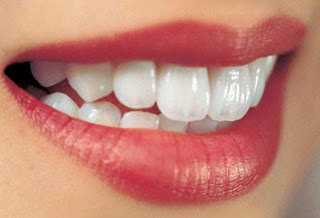 7 nguyên nhân khiến răng ê buốt bạn nên tránh 2